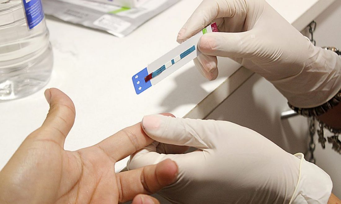 Realizarán test rápidos gratuitos de VIH en la UNSa