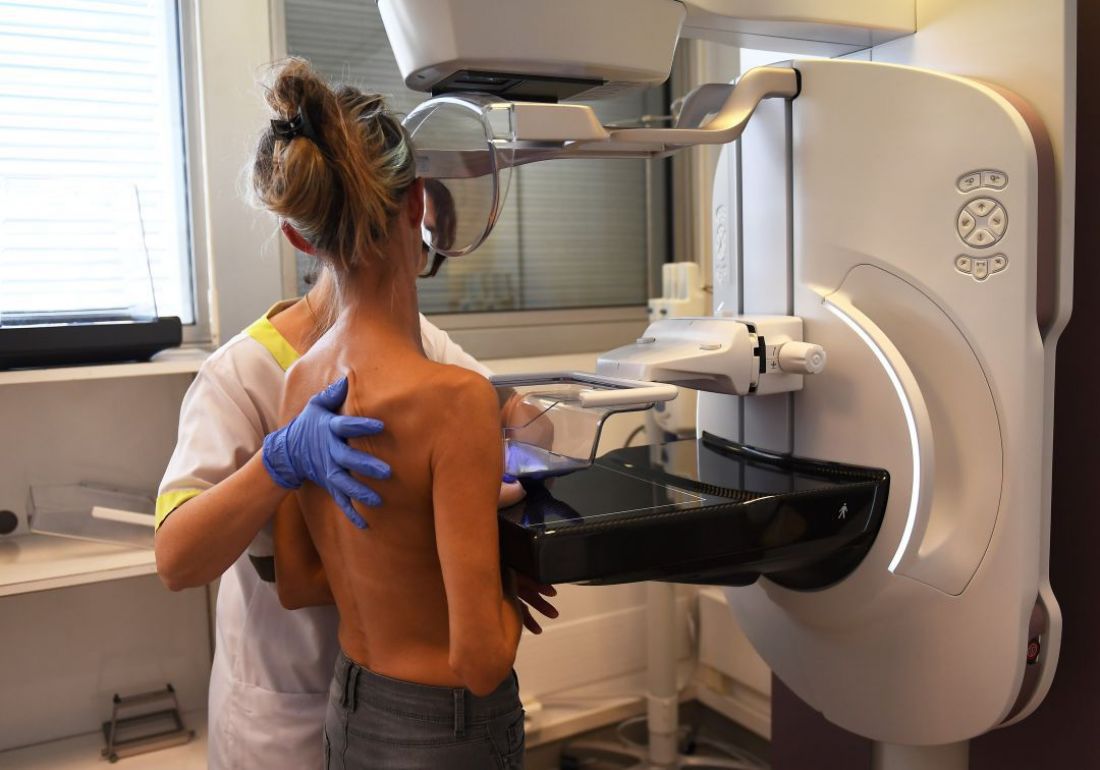 Por miedo al coronavirus, el 70% de salteñas no se hicieron la mamografía anual